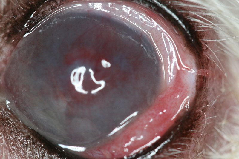 Ulcère cornéen très sévère